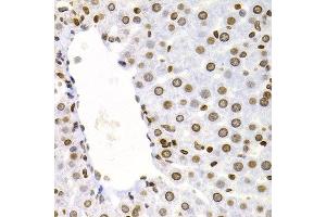 Immunohistochemistry of paraffin-embedded rat liver using NFKB2 antibody at dilution of 1:200 (400x lens). (NFKB2 antibody)