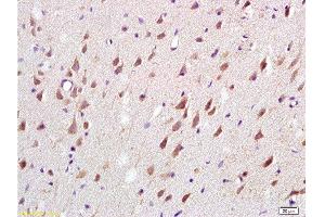 Formalin-fixed and paraffin embedded: rat brain tissue labeled with Anti-MAG-a/L-MAG Polyclonal Antibody , Unconjugated at 1:200, followed by conjugation to the secondary antibody and DAB staining