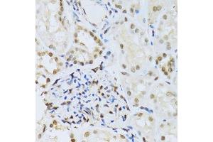Immunohistochemistry (Paraffin-embedded Sections) (IHC (p)) image for anti-Mitogen-Activated Protein Kinase 3 (MAPK3) (AA 1-100) antibody (ABIN3020725)