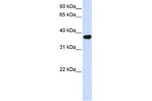 WB Suggested Anti-ICMT Antibody Titration:  0. (ICMT antibody  (Middle Region))
