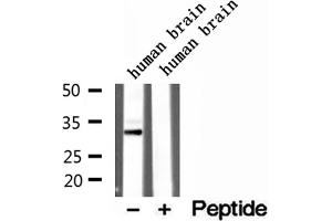 Western blot analysis of extracts of human brain tissue, using CAPZA1 antibody. (CAPZA1 antibody  (Internal Region))