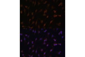 Immunofluorescence analysis of C6 cells using CYPOR Polyclonal Antibody (ABIN6130227, ABIN6145969, ABIN6145970 and ABIN7101824) at dilution of 1:100 (40x lens).
