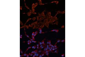 Immunofluorescence analysis of NIH/3T3 cells using DN antibody  at dilution of 1:100.