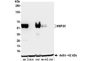 Western Blotting (WB) image for anti-Myocyte Enhancer Factor 2C (MEF2C) (AA 425-475) antibody (ABIN7795747) (Recombinant MEF2C antibody  (AA 425-475))