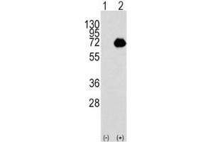 Western blot analysis of ACOX1 antibody and 293 cell lysate either nontransfected (Lane 1) or transiently transfected with the ACOX1 gene (2). (ACOX1 antibody  (AA 629-659))