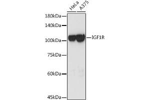 Western blot analysis of extracts of various cell lines, using IGF1R antibody (ABIN3020767, ABIN3020768, ABIN3020769 and ABIN6213714) at 1:3000 dilution. (IGF1R antibody  (AA 660-760))