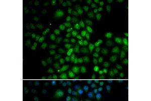 Immunofluorescence analysis of HeLa cells using C11orf30 Polyclonal Antibody (EMSY antibody)