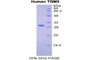 SDS-PAGE (SDS) image for Transglutaminase 3 (E Polypeptide, Protein-Glutamine-gamma-Glutamyltransferase) (TGM3) (AA 468-693) protein (His tag) (ABIN1171488) (TGM3 Protein (AA 468-693) (His tag))