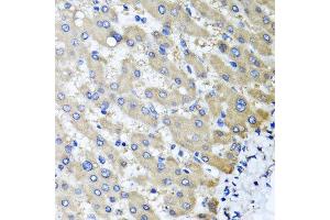 Immunohistochemistry of paraffin-embedded human liver injury using RBP2 antibody at dilution of 1:100 (x40 lens). (RBP2 antibody)