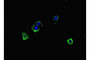 Immunofluorescent analysis of HepG2 cells using ABIN7150168 at dilution of 1:100 and Alexa Fluor 488-congugated AffiniPure Goat Anti-Rabbit IgG(H+L) (ERCC1 antibody  (AA 1-323))