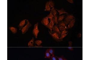 Immunofluorescence (IF) image for anti-BRCA1 Associated Protein-1 (Ubiquitin Carboxy-terminal Hydrolase) (BAP1) antibody (ABIN7262383)
