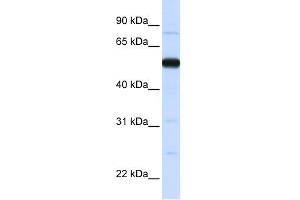 WB Suggested Anti-THUMPD2 Antibody Titration:  0. (THUMPD2 antibody  (N-Term))