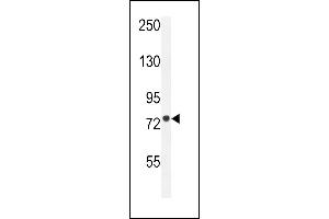 CPT1C Antibody (C-term) (ABIN655406 and ABIN2844952) western blot analysis in HL-60 cell line lysates (35 μg/lane). (CPT1C antibody  (C-Term))