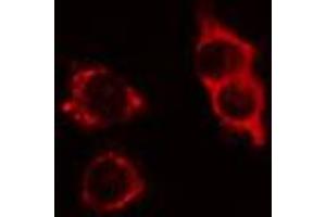 ABIN6274412 staining LOVO cells by IF/ICC. (ATPBD3 antibody  (C-Term))