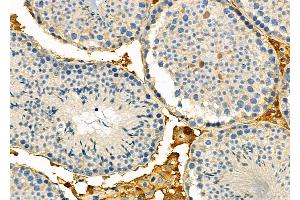 ABIN6257643 and ABIN6274758 at 1/100 staining Mouse testis tissue by IHC-P.