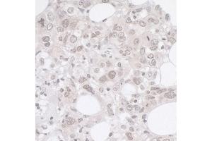 Immunohistochemistry (IHC) image for anti-Adhesion Regulating Molecule 1 (Adrm1) (AA 357-407) antibody (ABIN7449390)