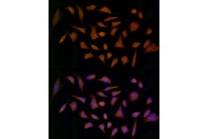 Immunofluorescence analysis of HeLa cells using MDK Rabbit pAb (ABIN3020790, ABIN3020791, ABIN3020792 and ABIN6213725) at dilution of 1:25 (40x lens). (Midkine antibody  (AA 21-143))