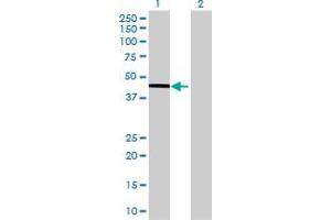 Western Blot analysis of ALKBH1 expression in transfected 293T cell line by ALKBH1 MaxPab polyclonal antibody. (ALKBH1 antibody  (AA 1-389))