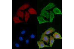 ABIN6264151 and ABIN6279649 staining Hela cells by IF/ICC. (PEX5 antibody  (Internal Region))