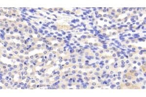 Detection of CAT in Mouse Kidney Tissue using Polyclonal Antibody to Catalase (CAT) (Catalase antibody  (AA 80-239))