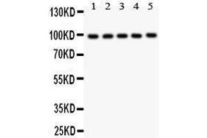 Anti- HCN1 antibody, Western blotting All lanes: Anti HCN1  at 0. (HCN1 antibody  (AA 618-890))