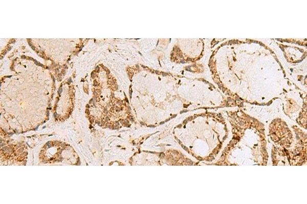 H3F3B antibody