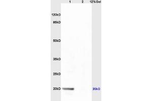 Lane 1: mouse live lysates Lane 2: mouse embryo lysates probed with Anti AVPR2 Polyclonal Antibody, Unconjugated (ABIN733478) at 1:200 in 4 °C. (Deoxyuridine Triphosphatase (DUT) (AA 151-252) antibody)