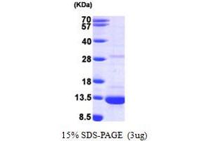 SDS-PAGE (SDS) image for Dynein, Light Chain, LC8-Type 1 (DYNLL1) (AA 1-89) protein (His tag) (ABIN667234)