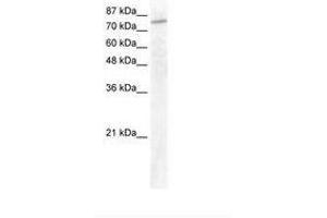 Image no. 1 for anti-General Transcription Factor IIIC, Polypeptide 3, 102kDa (GTF3C3) (AA 40-89) antibody (ABIN202944) (GTF3C3 antibody  (AA 40-89))