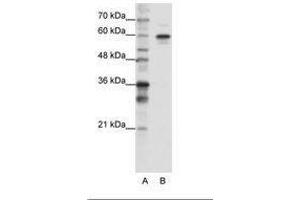 Image no. 3 for anti-Heterogeneous Nuclear Ribonucleoprotein L-Like (HNRPLL) (AA 24-73) antibody (ABIN202737) (HNRPLL antibody  (AA 24-73))