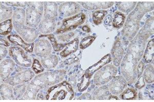 Immunohistochemistry of paraffin-embedded Mouse kidney using ITGAV Polyclonal Antibody at dilution of 1:50 (40x lens). (CD51 antibody)