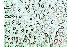 Immunohistochemical analysis of paraffin-embedded human-kidney, antibody was diluted at 1:200 (PTH1R antibody  (AA 1268-1341))