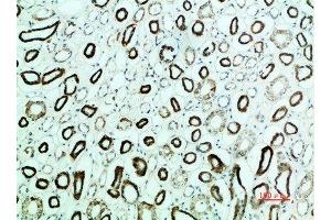 Immunohistochemical analysis of paraffin-embedded human-kidney, antibody was diluted at 1:200 (PTH1R antibody  (AA 1268-1341))