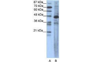 WB Suggested Anti-SRF Antibody Titration:  1. (SRF antibody  (N-Term))