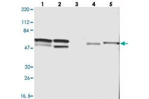 Western blot analysis of Lane 1: RT-4, Lane 2: U-251 MG, Lane 3: Human Plasma, Lane 4: Liver, Lane 5: Tonsil with CDCA7 polyclonal antibody  at 1:250-1:500 dilution.