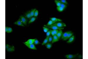 Immunofluorescence staining of HepG2 cells with ABIN7142464 at 1:100, counter-stained with DAPI. (HOGA1 antibody  (AA 1-164))