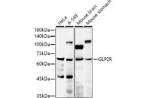 Western blot analysis of extracts of various cell lines, using GLP2R antibody (ABIN6127974, ABIN6141141, ABIN6141142 and ABIN6222287) at 1:500 dilution. (GLP2R antibody  (AA 1-180))