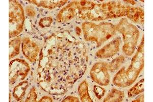 Immunohistochemistry of paraffin-embedded human kidney tissue using ABIN7160805 at dilution of 1:100 (SLC9A3R2 antibody  (AA 106-313))