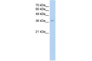 WB Suggested Anti-GHRHR Antibody Titration:  0. (GHRHR antibody  (C-Term))