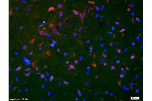 Formalin-fixed and paraffin-embedded rat brain labeled with Anti-Smoothened/SMO Polyclonal Antibody, Unconjugated (ABIN680908) 1:200, overnight at 4°C, The secondary antibody was Goat Anti-Rabbit IgG, Cy3 conjugated used at 1:200 dilution for 40 minutes at 37°C. (SMO antibody  (AA 551-650))