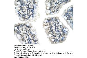 Rabbit Anti-GIPC2 Antibody  Paraffin Embedded Tissue: Human Intestine Cellular Data: Epithelial cells of intestinal villas Antibody Concentration: 4. (GIPC2 antibody  (N-Term))