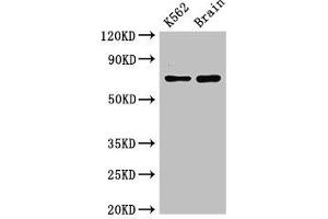 Western Blot Positive WB detected in: K562 whole cell lysate, Mouse brain tissue All lanes: SLU7 antibody at 3 μg/mL Secondary Goat polyclonal to rabbit IgG at 1/50000 dilution Predicted band size: 69 kDa Observed band size: 69 kDa (SLU7 antibody  (AA 138-310))