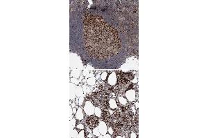 Immunohistochemical staining of human bone marrow with KIF4A polyclonal antibody  shows strong nuclear positivity in hematopoietic cells at 1:200-1:500 dilution. (KIF4A antibody)
