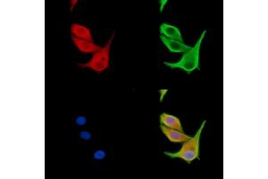 ABIN7095004 and ABIN7099060 staining HepG2 cells by IF/ICC.
