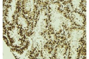 ABIN6273011 at 1/100 staining Human lung tissue by IHC-P. (NUDT21 antibody  (Internal Region))