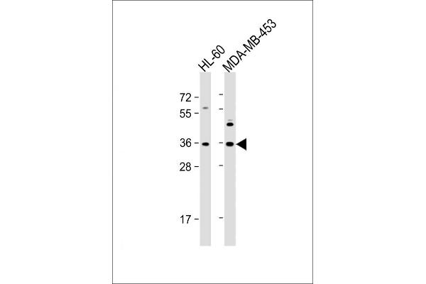 OR1J4 antibody  (C-Term)