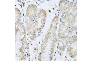 Immunohistochemistry of paraffin-embedded human stomach using FANCA antibody (ABIN5975159) at dilution of 1/100 (40x lens). (FANCA antibody)