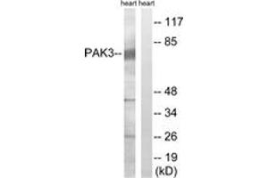 Western blot analysis of extracts from rat heart cells, using PAK3 (Ab-154) Antibody.