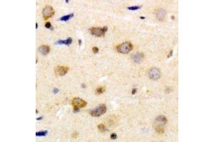 Immunohistochemistry (IHC) image for anti-Caldesmon 1 (CALD1) (C-Term), (pSer789) antibody (ABIN7303956)