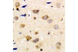 Immunohistochemical analysis of Caldesmon (pS789) staining in human brain formalin fixed paraffin embedded tissue section. (Caldesmon antibody  (C-Term, pSer789))
